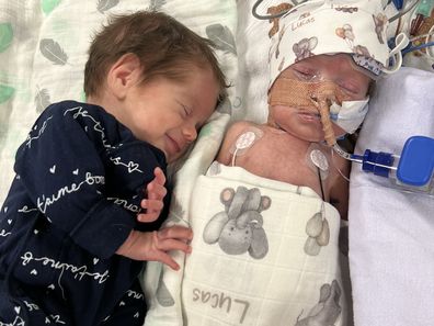 Lucas and Bailey were born 13 weeks prematurely 
