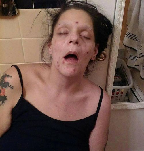 Melissa Matos has shown this photo of her which was taken at the height of her addiction. Picture: Facebook