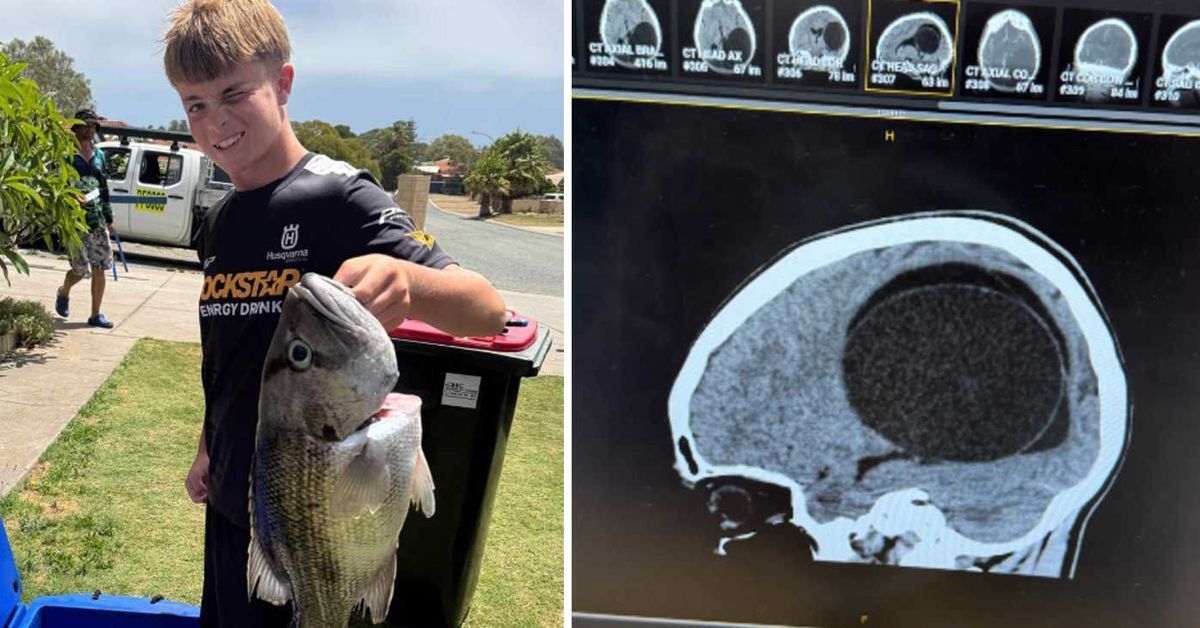 Freak dirt bike accident uncovers unrelated condition that leaves doctors ...