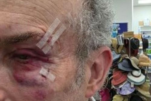 Melbourne pharmacy owner brutally assaulted