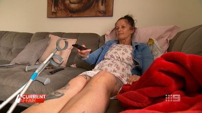 Woman fears she'll become amputee due to surgery backlog