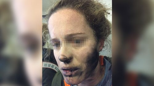 She had been sleeping on the plane when she heard a loud explosion. (ATSB)