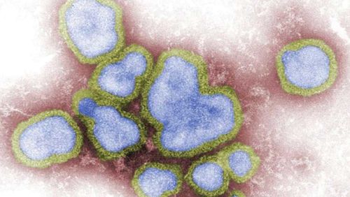 Influenza A is a particularly nasty virus spreading around Australia.
