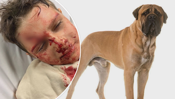 Seven year old child attacked by dog in Perth