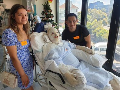 Stephanie Browitt spent two weeks in a come after the volcano eruption left her with third degree burns on 65 per cent of her body.