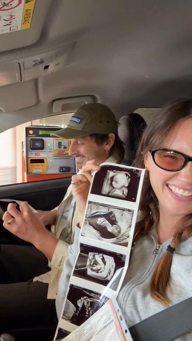 Australian influencer Daphne Berry apologizes for pretending to drink while pregnant