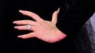 Adele wears a giant ring