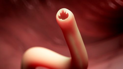 Hookworm protein may 'cure' asthma and other auto-immune diseases