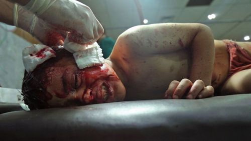 A boy is treated in a clinic in Damascus. (Photo: AFP)