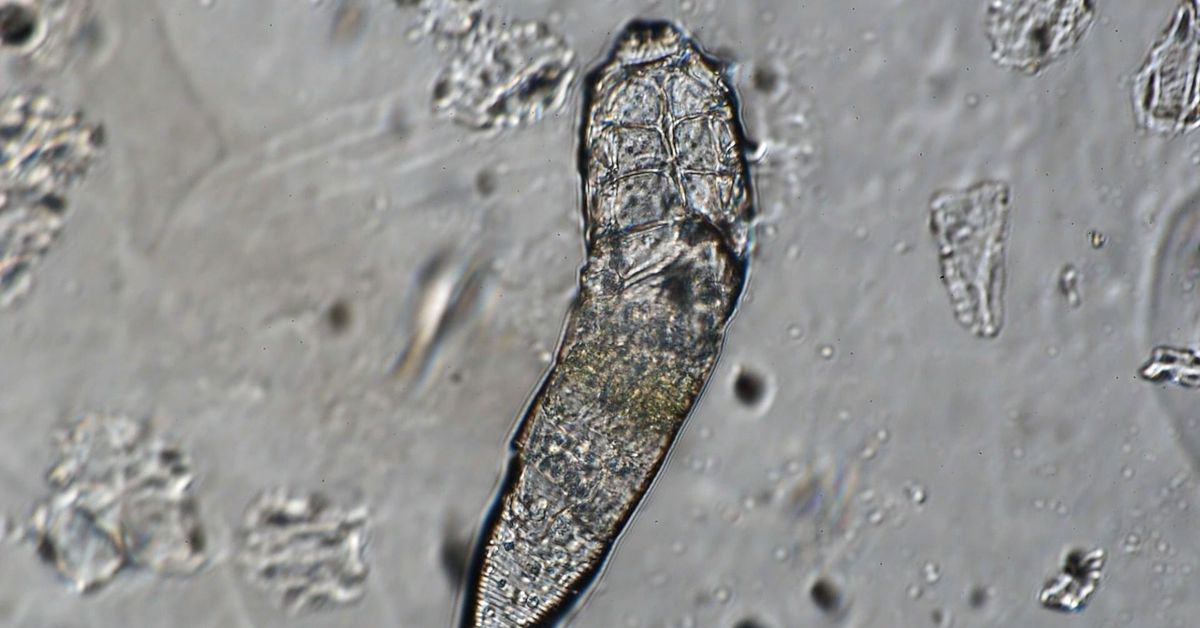 While you sleep, these bugs throw a party on your face