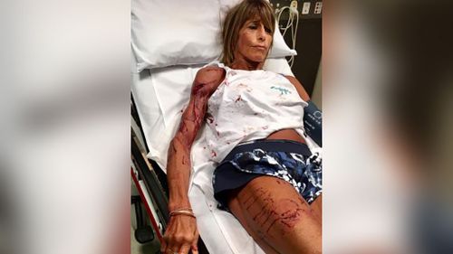 The personal trainer had to undergo emergency surgery for her injuries. (Source/ Manningham Leader)