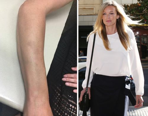 Ms Landry alleged her arm was bruised during a physical altercation with Mr Bell. Source: AAP