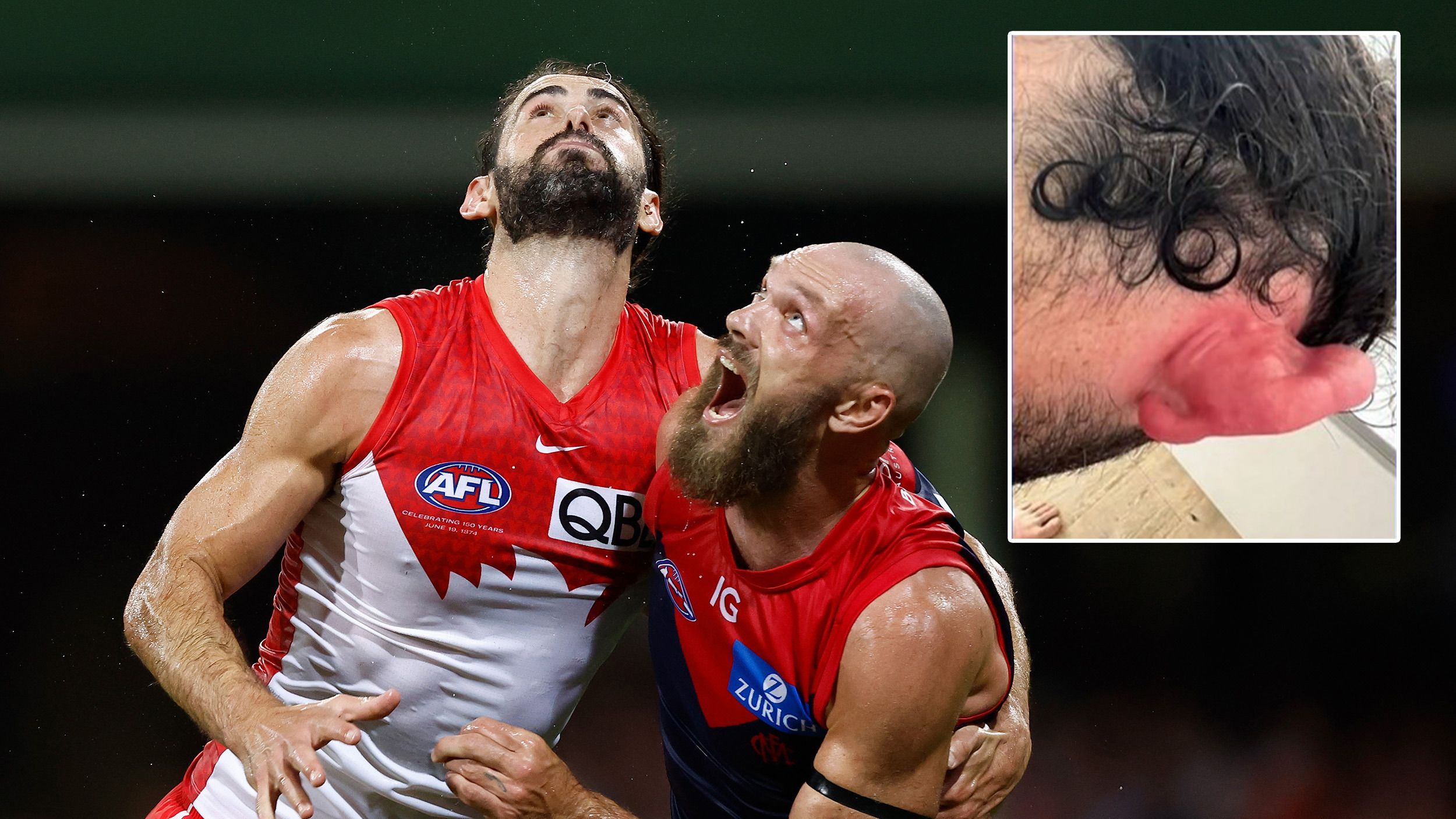 Star overcomes 'worst pain I've ever felt' to dominate former club in Swans victory