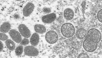The monkeypox virus is seen through a micropscope.