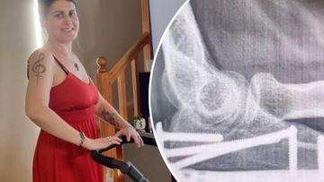 Sarah Briscoe-Hough was hit by an e-bike while crossing the road.