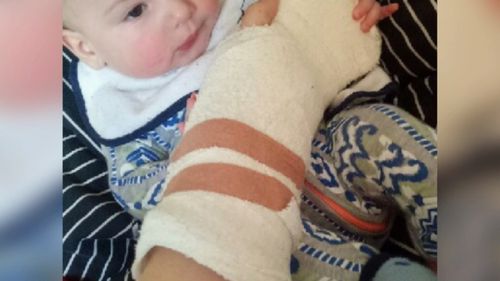 The mother-of-one claims she instinctively held out her hand to protect her six-month-old son.