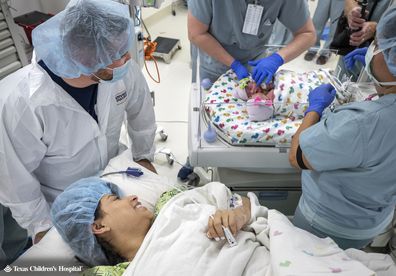 Sandy and Jesse seeing their conjoined twin daughters for the first time.