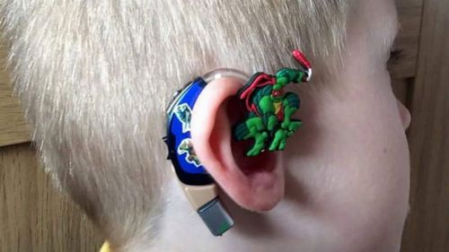 UK mum makes cochlear implants cool with superhero stickers