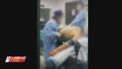 In social media posts, Dr Lanzer brags about removing amounts of fat others in the industry say is simply dangerous.His staff also partake in videos, some seen dancing to a Dolly Parton song as they work on a patient.