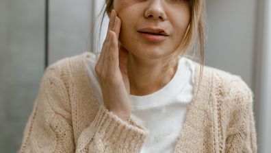 Stock image of a woman with a bruised face, domestic abuse.