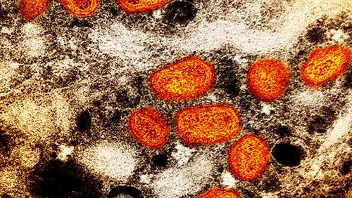 The monkeypox virus viewed through a microscope.