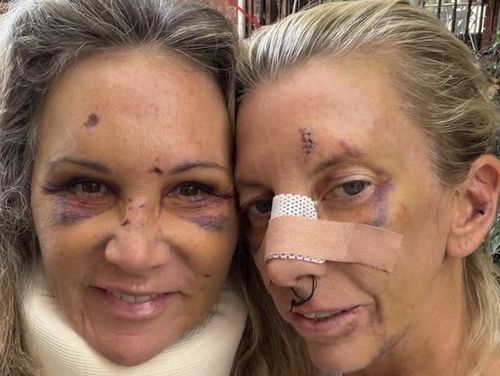 Storia di Instagram che mostra le vittime dell'attacco di Potts Point Christine Campeau (a sinistra) e Chloe Paul.