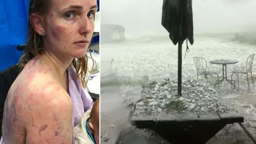 Fiona Simpson was battered as she tried to protect her infant daughter from a vicious hail storm.