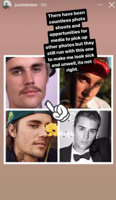 Justin Bieber calls out media for continuing to share images of him looking unwell.