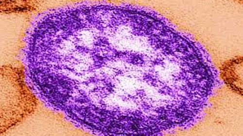 A microscopic image of the measles virus.