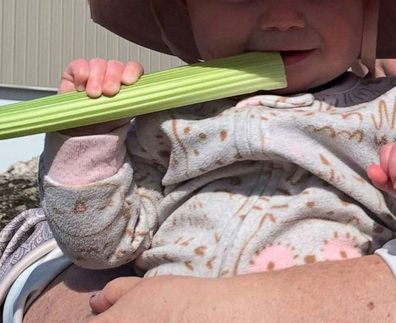 Mum's warning after baby suffers 'margarita burns' from celery