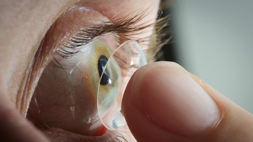  Doctors find 27 lost contact lenses in woman’s eye