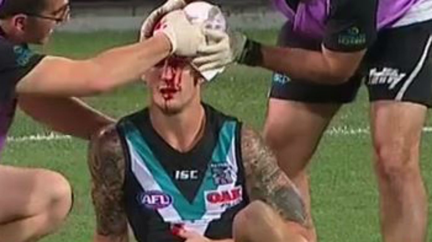 Port Adelaide defender Hamish Hartlett stretchered off after sickening head clash