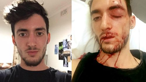 Sydney man says he was bashed for wearing a dress and makeup