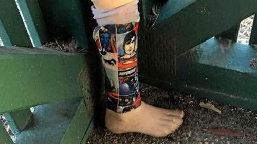 Woman reunites three-year-old boy with Superman prosthetic leg