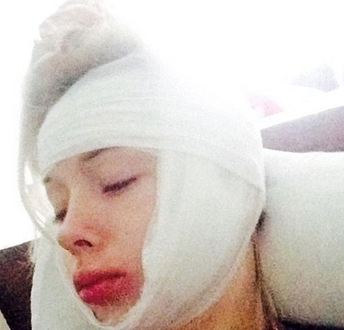 The model suffered head injuries from the attack. (east2west news)