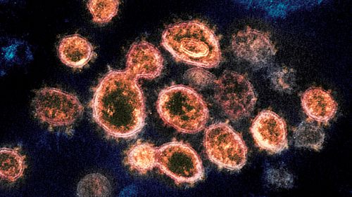 This electron microscope image shows SARS-CoV-2 virus particles which cause COVID-19.