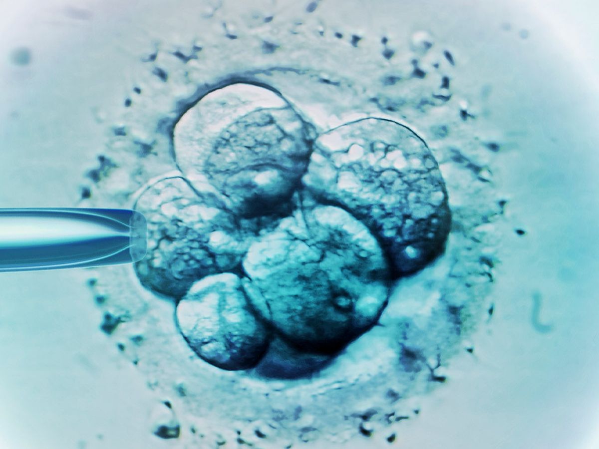 68 - Secrets of the Affordable IVF Model and How it is Poised to