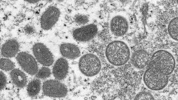 This electron microscopic (EM) image depicted a monkeypox virion, obtained from a clinical sample associated with the 2003 prairie dog outbreak. It was a thin section image from of a human skin sample. On the left were mature, oval-shaped virus particles, and on the right were the crescents, and spherical particles of immature virions. High Resolution:	Click here for hi-resolution image (5.21 MB) Content Providers(s):	CDC/ Cynthia S. Goldsmith Creation Date:	2003 Photo Credit:	Cynthia S. Goldsmi