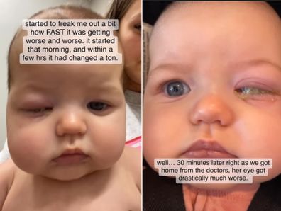 Mum Krisha's warning about baby's eye condition