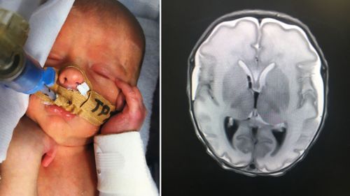 Baby Jaxson O'Regan and his MRI scan. (Supplied)