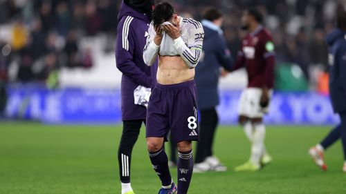 Manchester United's failure to win means Ilett's wait for a haircut will span well over 500 days.