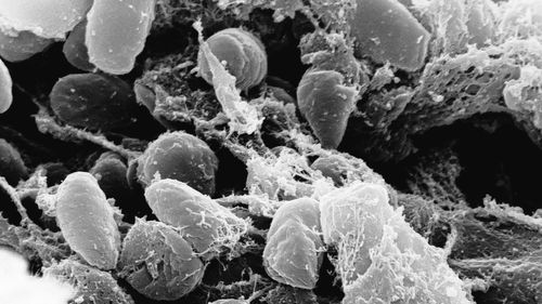 Although plague is inextricably linked to the Black Death pandemic of the 14th century that killed about 50 million people in Europe, it remains a relatively common disease.