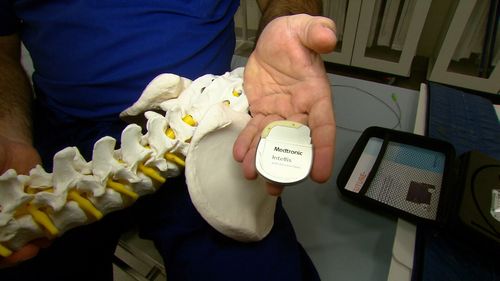 Sydney orthopaedic surgeon Professor Ian Harris wants more studies done on the effectiveness of devices like the Intellis. (9NEWS)