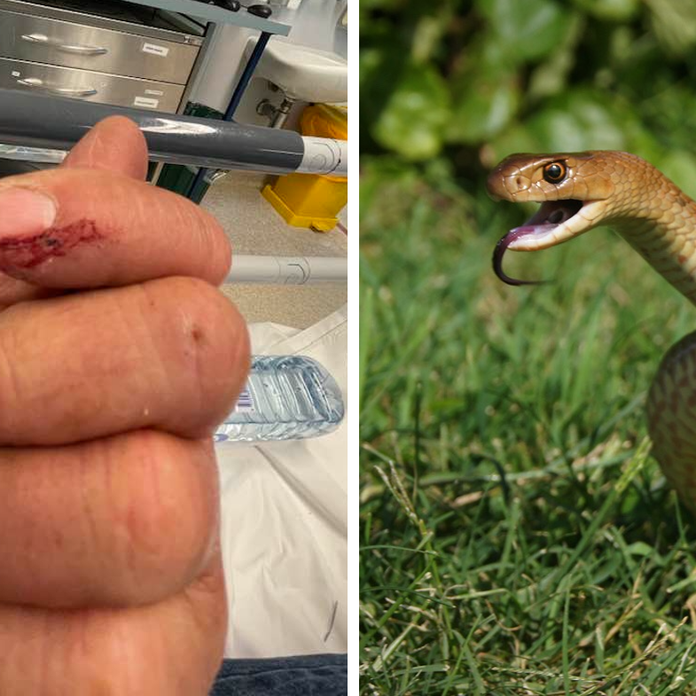 Snake Catcher's Harrowing Story Of Surviving A Brown Snake Bite