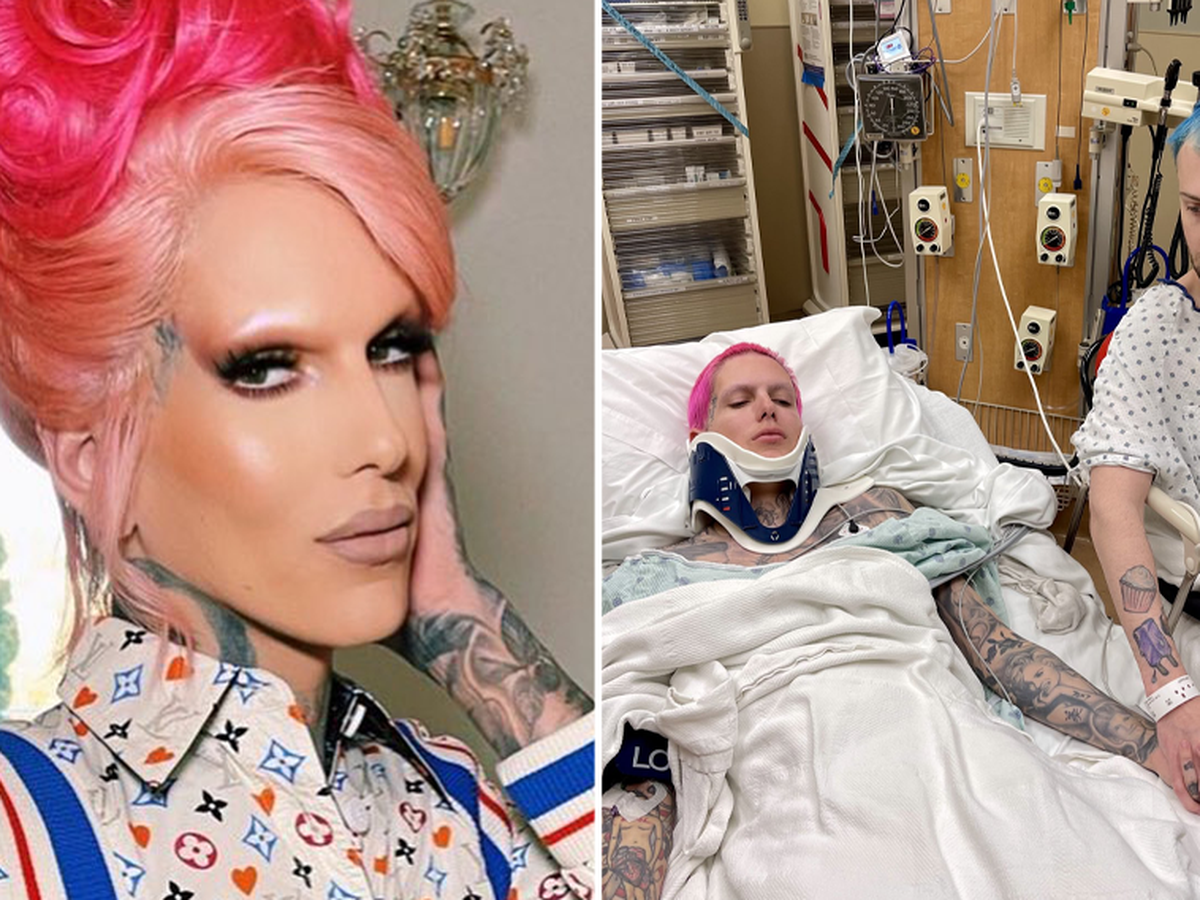 Jeffree Star car accident:  star seriously injured - 9Celebrity