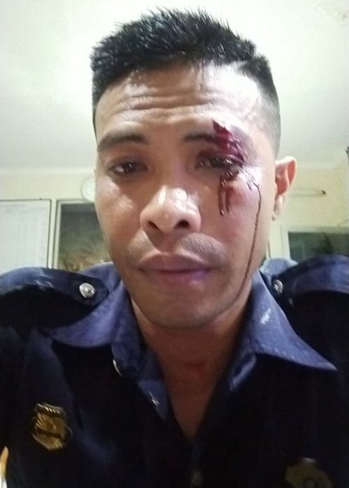 Bali bouncer Adni Junus Liu  allegedly punched by Australian teen Zac William Whiting 2