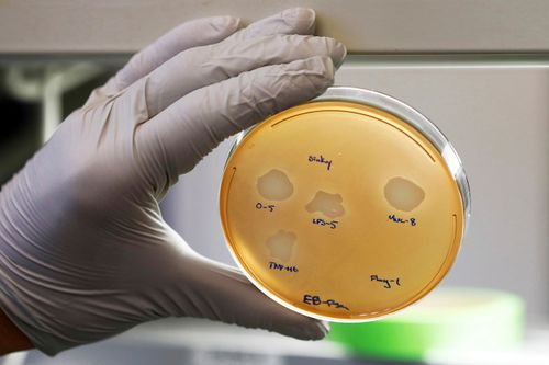 A petri dish containing the Pseudomonas aeruginosa lung samples grown from patient, Balasa.