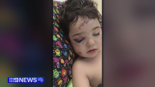 Perth mum's 'living nightmare' after four-year-old attacked by dog