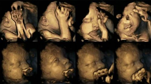 Unborn baby grimaces, covers face in smoking mother’s womb, according to astounding new scans revealed by UK study