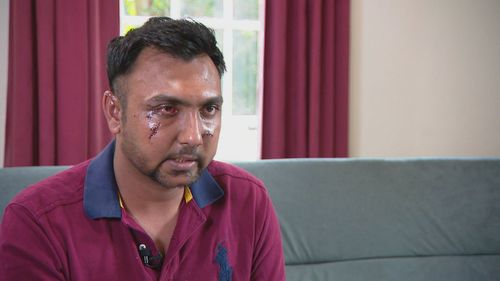 A man who was allegedly glassed while he tried to sell his car in Adelaide has spoken out hours after leaving hospital. Muhammad Bilal, 31, wanted to sell his Subaru Impreza on Facebook marketplace three days ago but instead he was left fearing for his life.